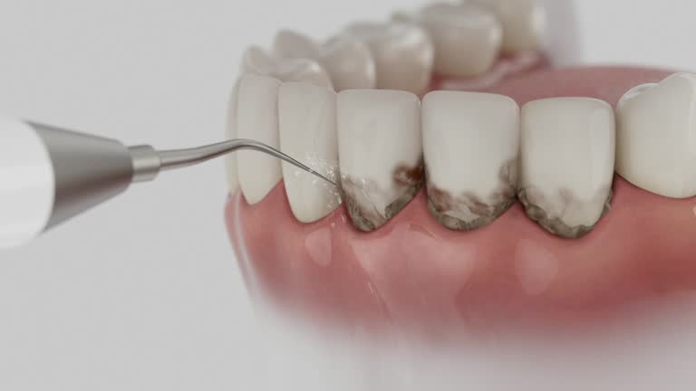 Reliable Dental contractor in St. Leon, IN by Dentist Open Now